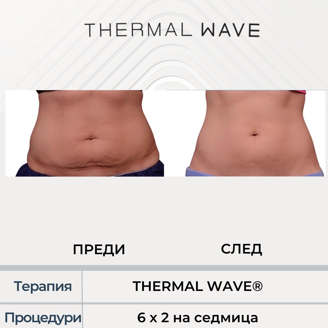 Корем преди и след THERMAL WAVE